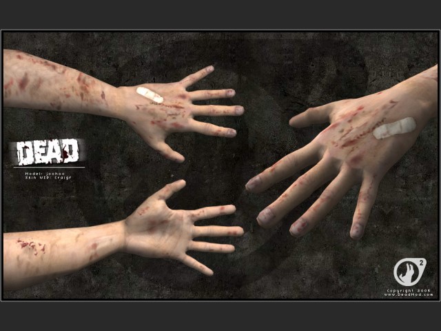 Zombie-Hnde