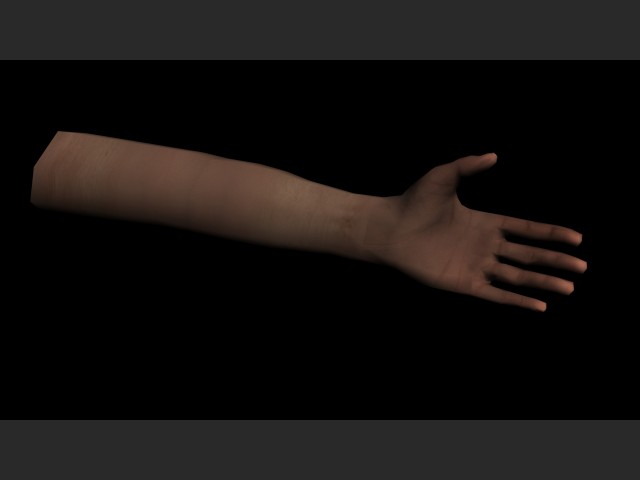 Arm